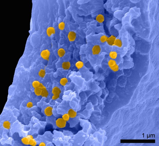 An electron microscope image of a zebrafinch feather showing colour pigments in orange