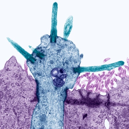 A coloured transmission electron micrograph showing  a section through smell receptors (projecting from an olfactory neurone