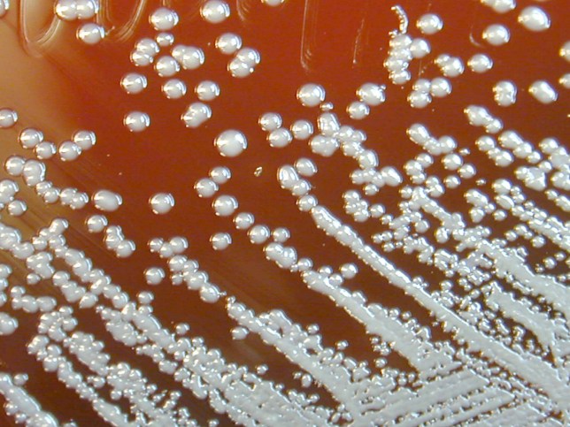 Burkholderia pseudomallei grown on sheep blood agar for 48 hours. Burkholderia pseudomallei is a Gram-negative aerobic bacteria, and is the causative agent of melioidosis. The organism's colonial morphology changes somewhat as the incubation is extended. Image courtesy CDC/Courtesy of Larry Stauffer, Oregon State Public Health Laboratory, 2002. (Photo by Smith Collection/Gado/Getty Images).