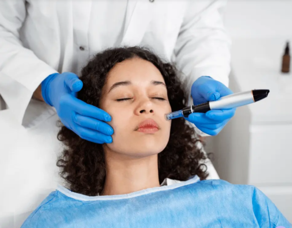 Microneedling in Chantilly