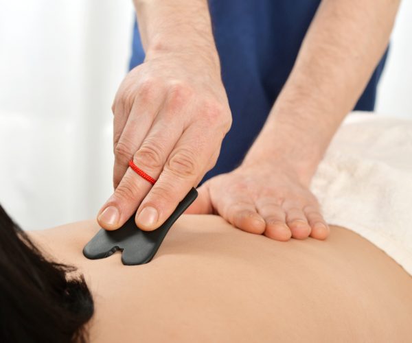 Woman receiving gua sha acupuncture treatment on back