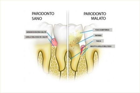 Parodontologia