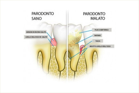 clinicasorriso parodontologia