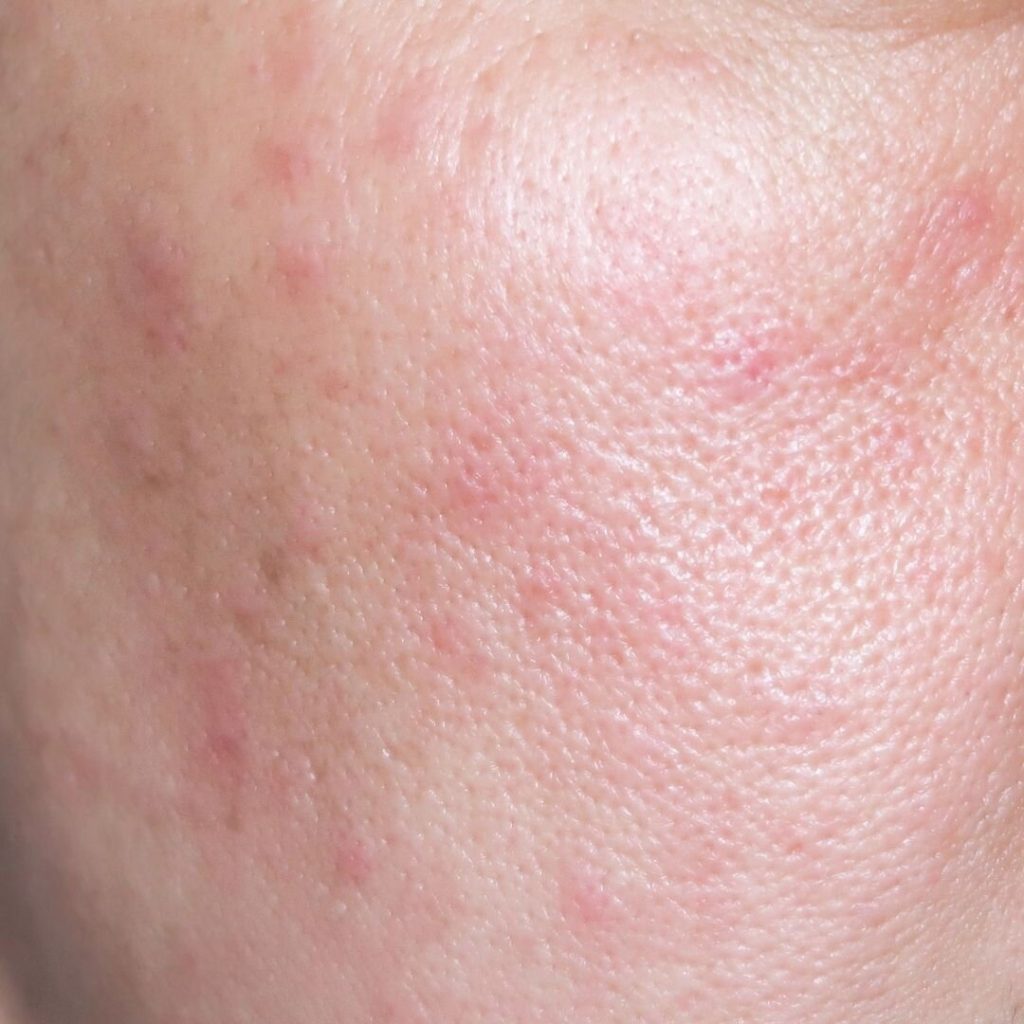 CLINICCARE