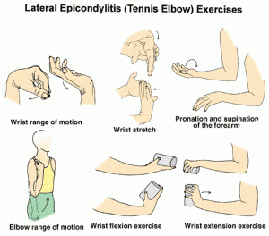 tennis-elbow-exercices. Osteopath