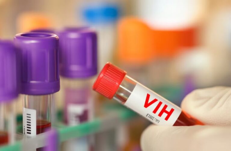 OPS aclara: VIH en República Dominicana no es nueva epidemia
