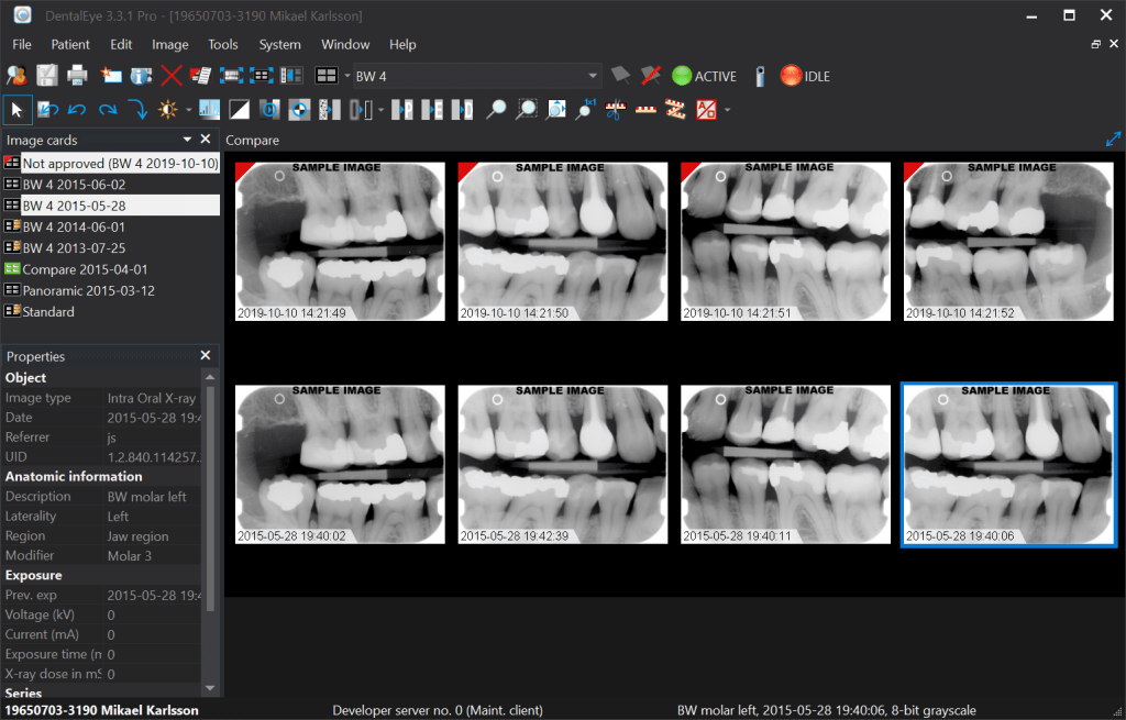 Dentaleye 3.3 program