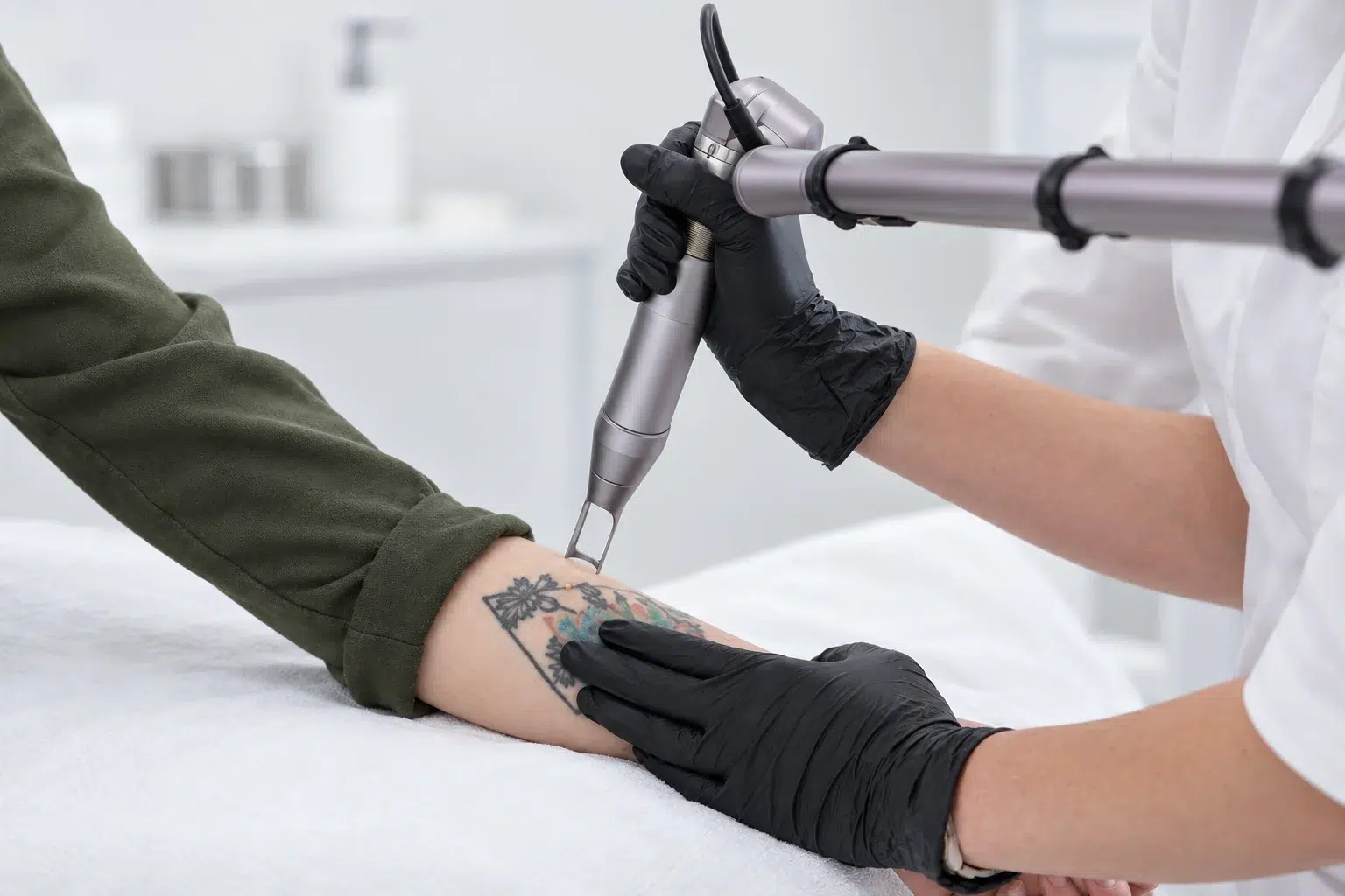 Kursus 2 Illustration af tatoveringsfjernelse med laser på en underarm.