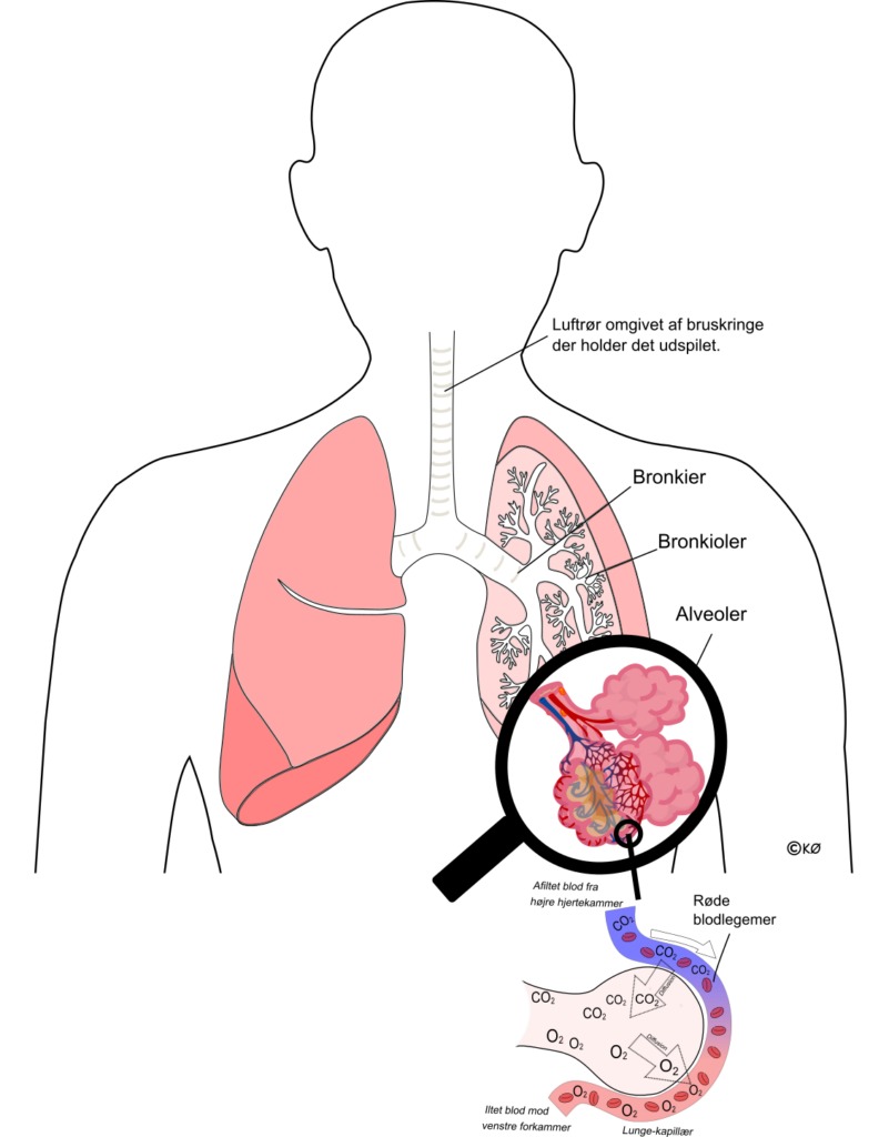 figur af krop med lungerne der viser afsnit i lungerne med alveoler bronkier og lungekapillærer