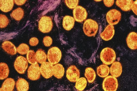 Foto: National Institute of Allergy and Infectious Diseases, Unsplash