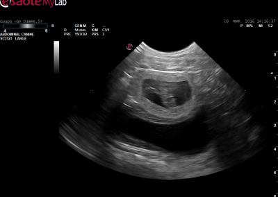 Echografie