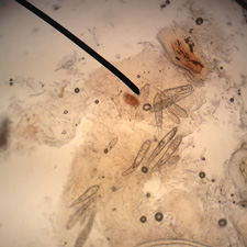 Huidmijt bij de hond (demodex)