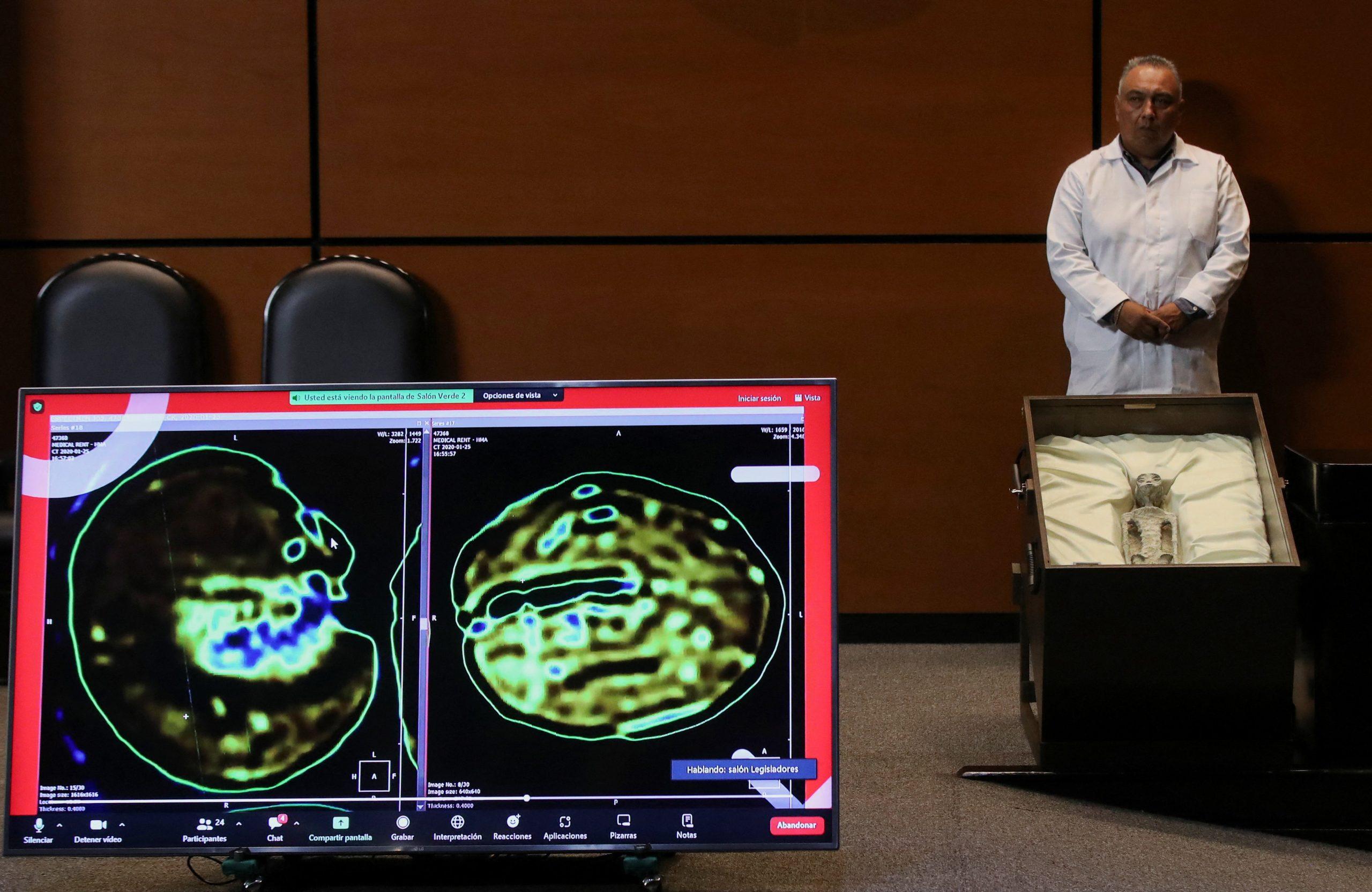 </p>
<p>X-rays of the specimens were also shown during the hearing, with experts testifying under oath that one of the bodies is seen to have “eggs” inside</p>
<p>