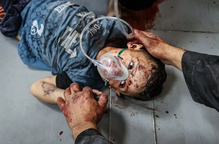 İsrail rezil oldu! CNN hastane yalanını ifşa etti, sonra sildi: Bakın savunmaları ne oldu