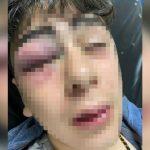 Diyarbakır Lice’de çocuğa işkence davasında sanık polislere ceza talebi