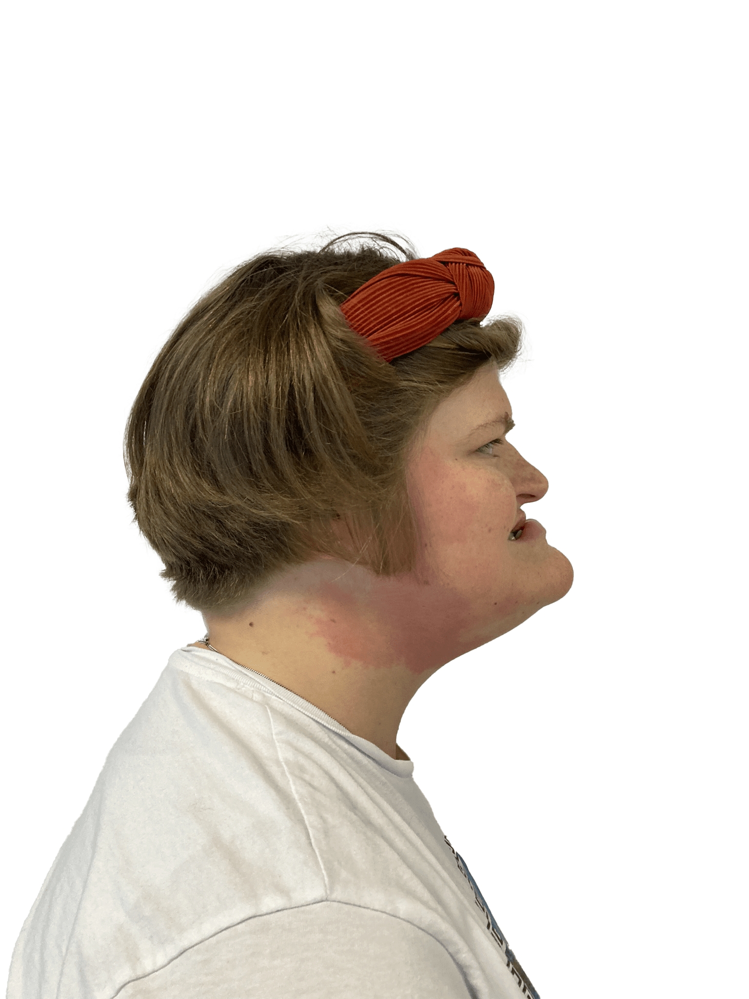 Anne Mette F