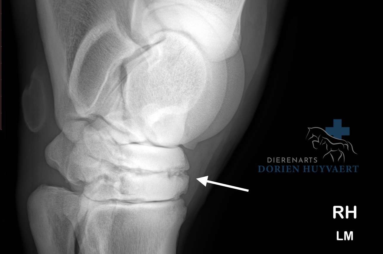 Radiografie