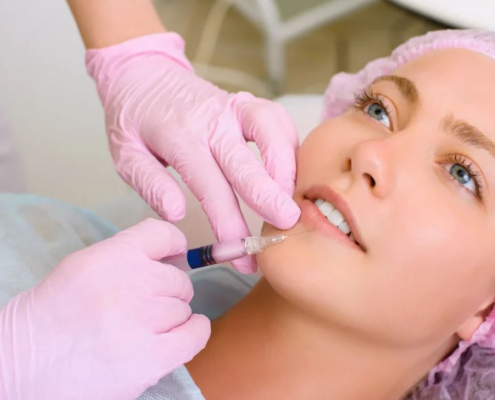 Dermal fillers in London