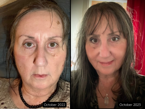 My Story: From Healing to Purpose