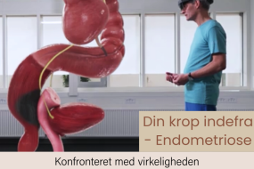 Konfronteret med endometriose