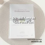 Du skal lære at leve med det