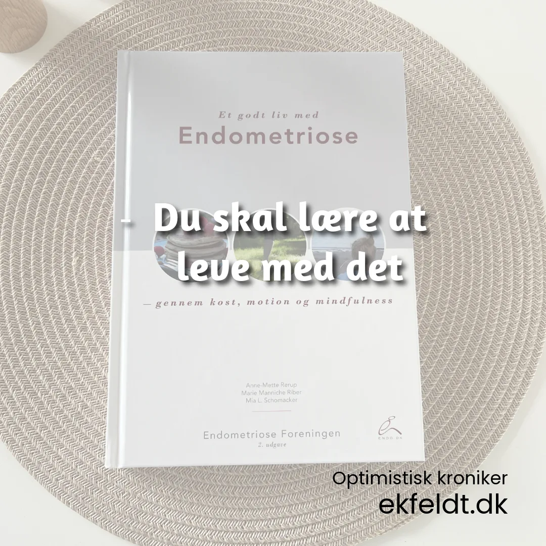 Du skal lære at leve med det