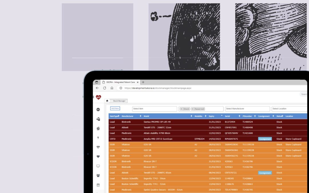 Introducing Enhanced Stock Reporting