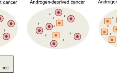 Complete metabolic response of metastatic castration-resistant neuroendocrine carcinoma of the prostate after treatment with RRx-001 and reintroduced platinum doublets.