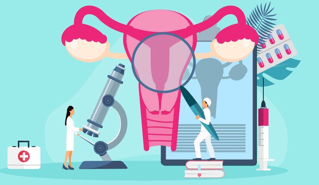 cervical cancer illustration