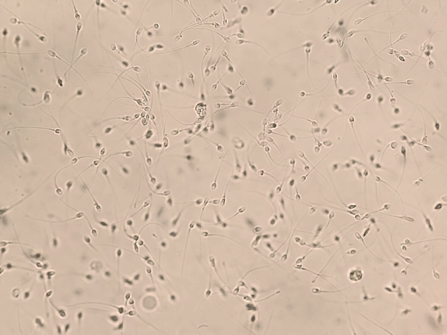 Hastler tv porno kanali Balashovdan yalangoch qizlar videosi