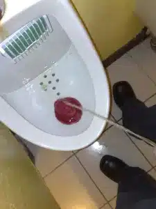Man urinating
