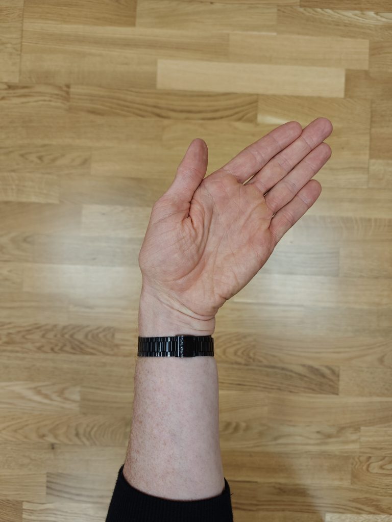 Wrist Ulnar Deviation