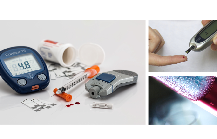 fedmeoperation kurere type 2 diabetes