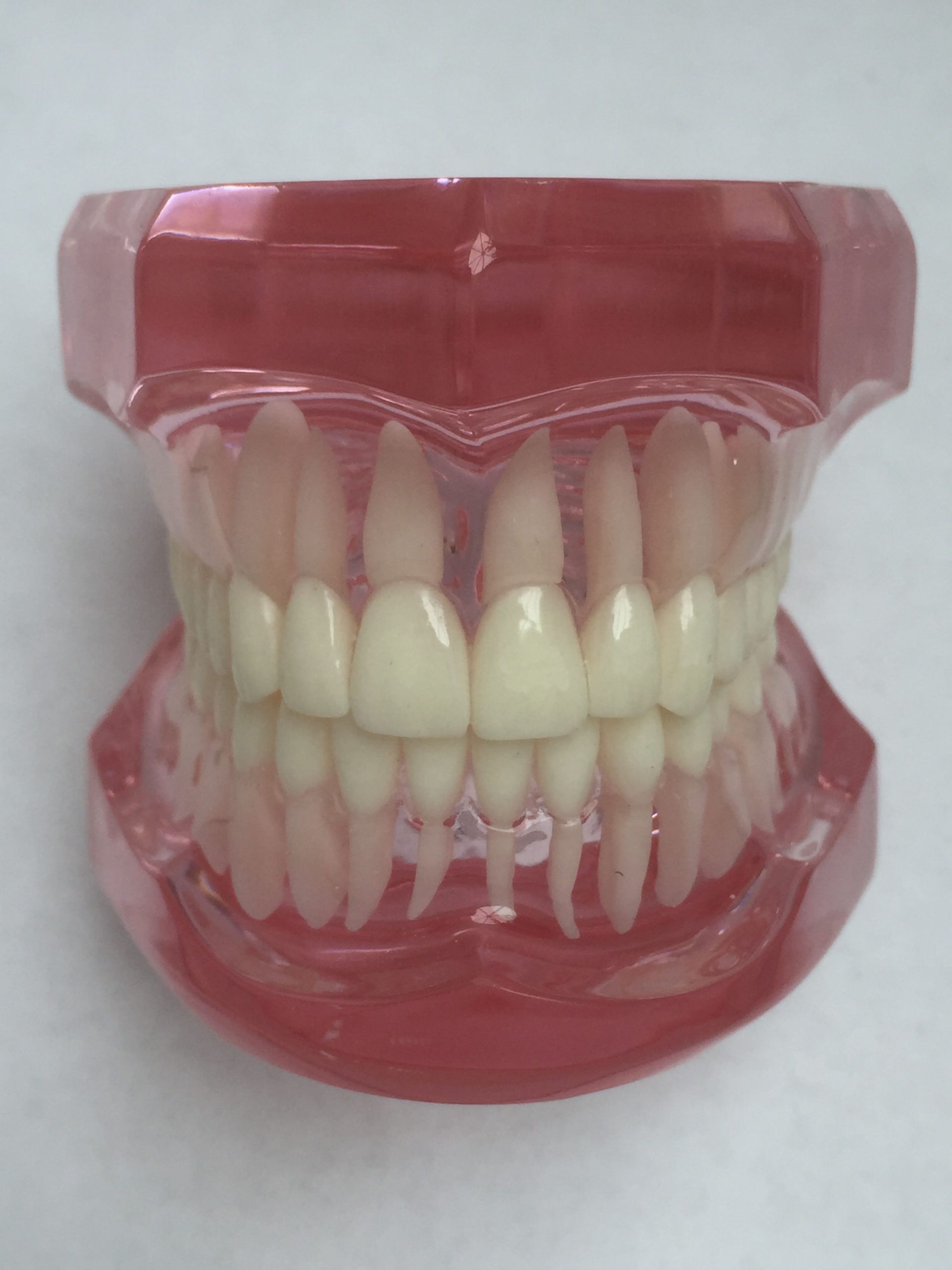 Gestenco Offers Freddy Ceramic Button and Hook for Aligner Treatment