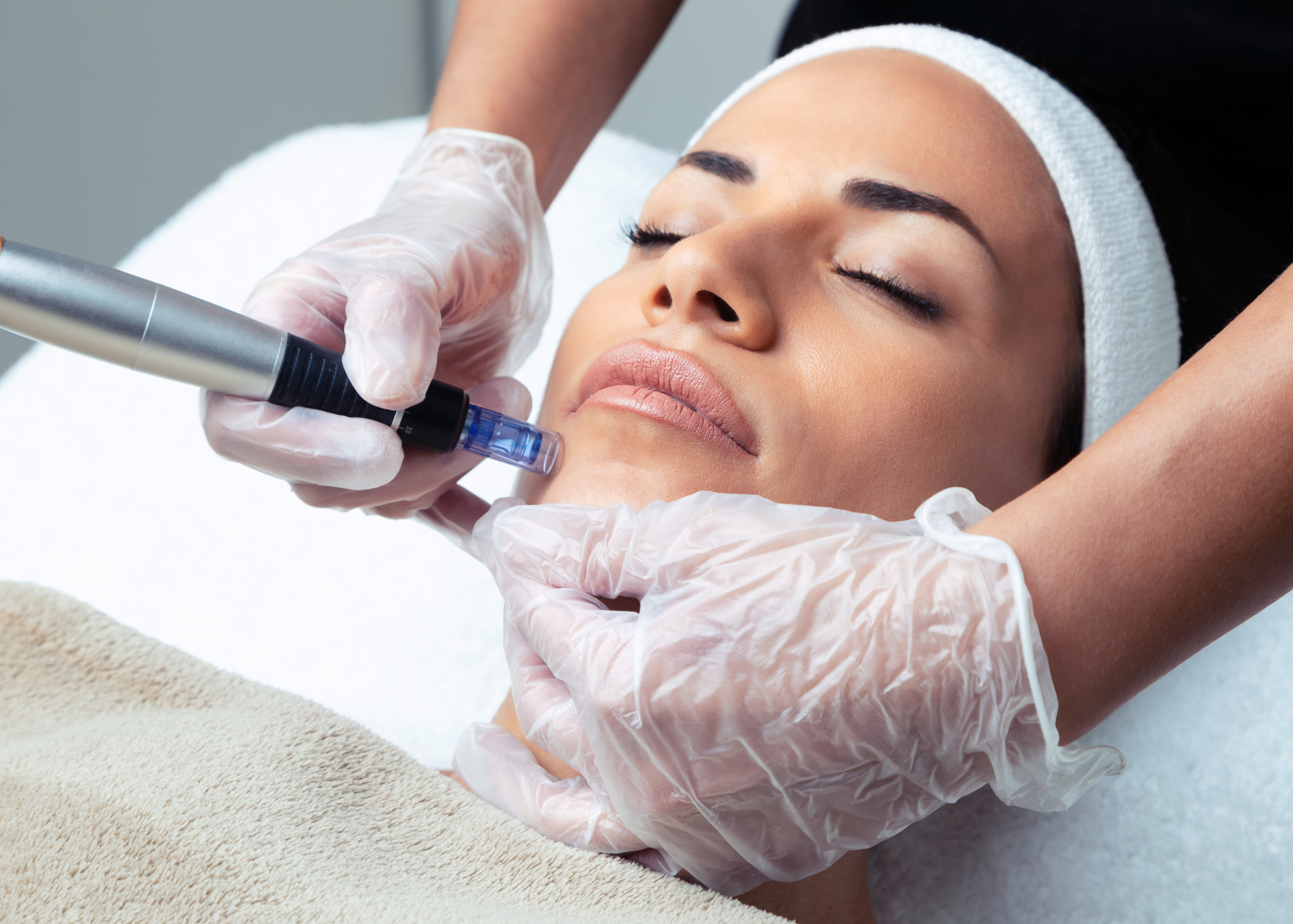 SkinPen (Microneedling)