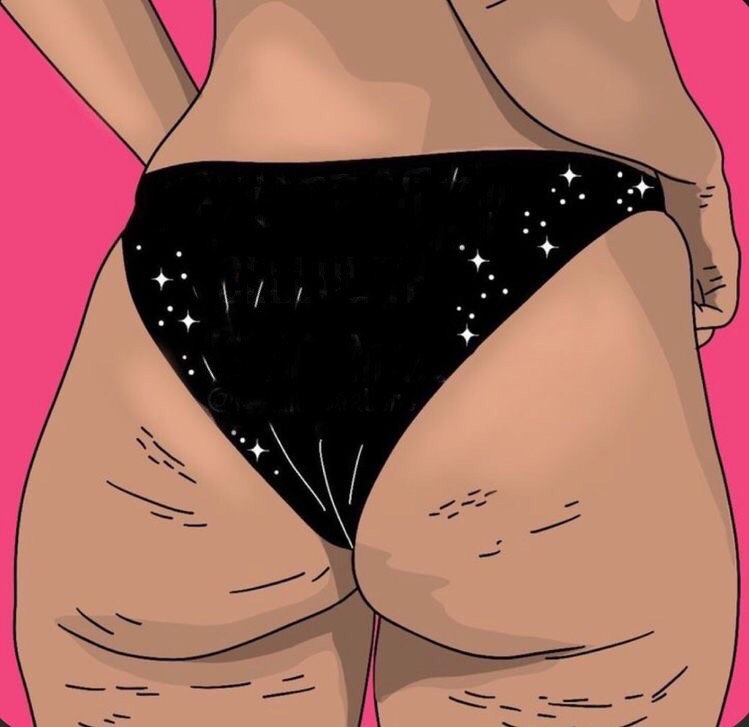 cellulite article minceur
