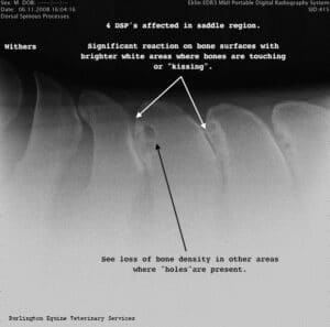 Kissing Spine Disease