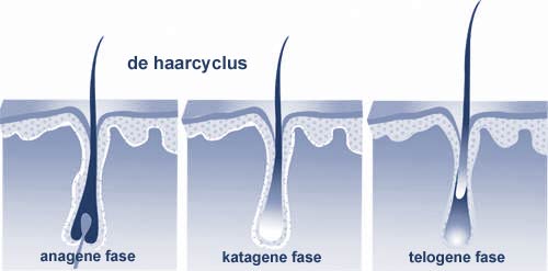 haaruitval haarverlies