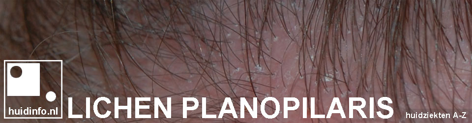 Lichen Planopilaris Huidinfo nl Dermatoloog