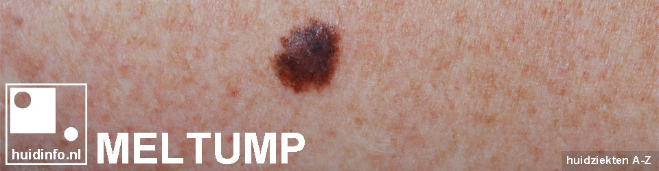 meltump