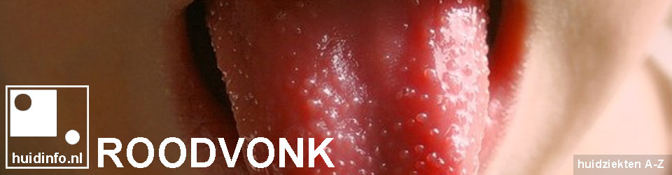 roodvonk