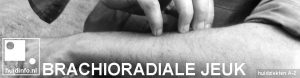 brachioradiale jeuk