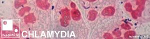 chlamydia