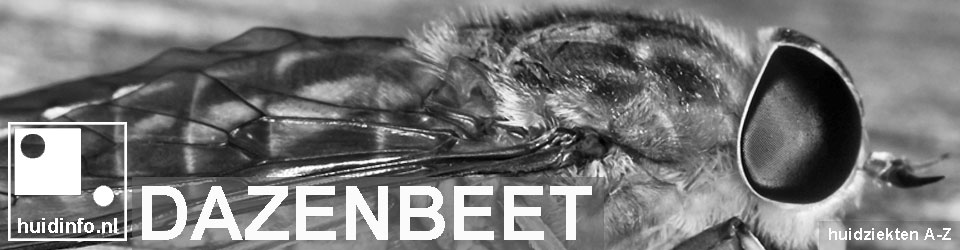 dazenbeet