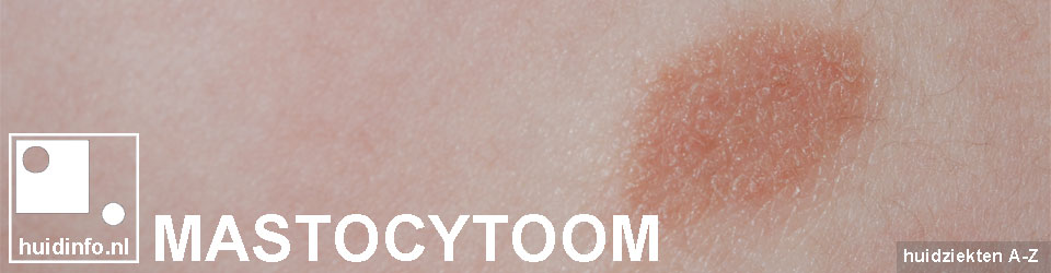 mastocytoom