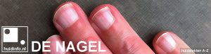 nagel