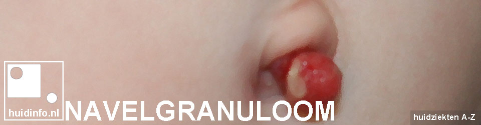 Navelgranuloom | info van de dermatoloog