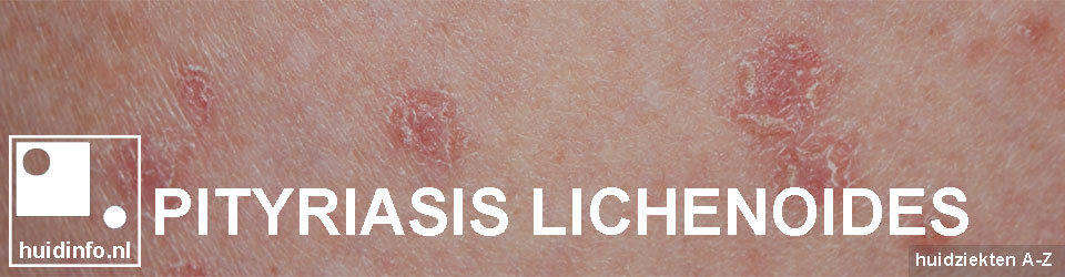 Pityriasis Lichenoides Huidinfonl Uitleg Van De Dermatoloog 