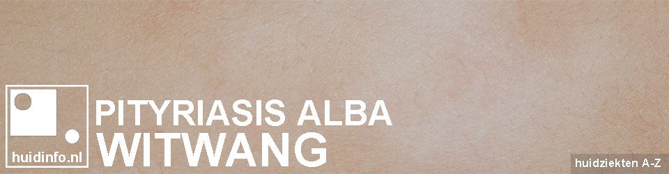 witwang pityriasis alba