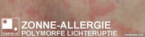 zonne-allergie zon polymorfe lichteruptie allergie